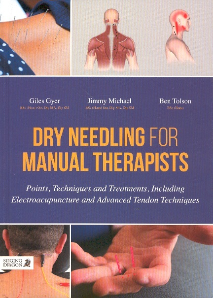 Dry Needling For Manual Therapists-Points,Techniq. & Treatm.,Incl.Electroacup.& Adv.Tendon Techniq.