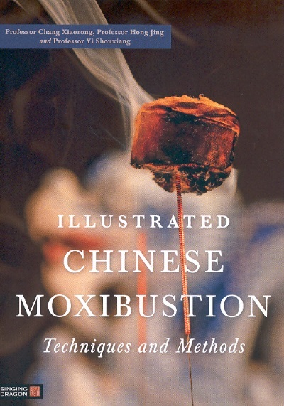 Illustrated Chinese Moxibustion Techniques & Methods